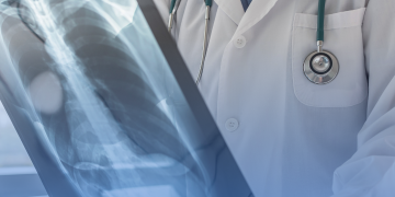 Em reunião da ANS, é aprovada a realização de audiência e abertura de consulta pública sobre tratamentos para câncer de pulmão, leucemia e linfoma, e consulta pública para atualização da DUT de asma