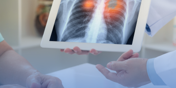 Consulta Pública 135: ANS recebe contribuições para atualização do Rol