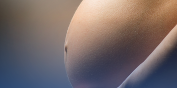 Osteoporose associada à gestação ainda é pouco conhecida