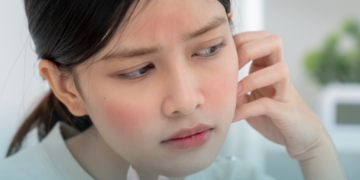 ANS aprova inclusão de tratamentos para câncer e dermatite atópica ao Rol