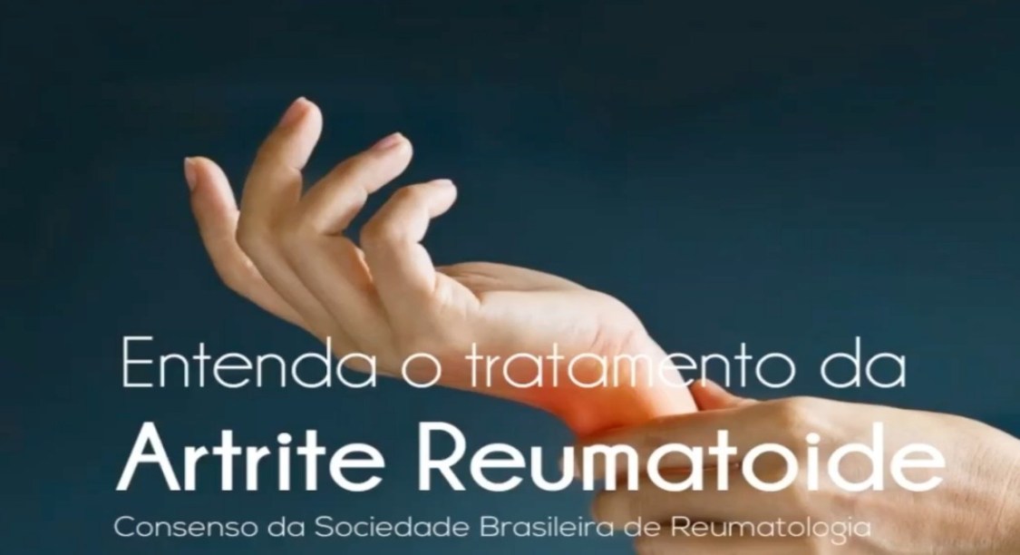 Quem tem osteoartrite deve evitar subir muitos lances de escada? –  EncontrAR – GRUPAR