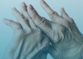 Artrite Reumatoide: 10 sintomas para nunca ignorar