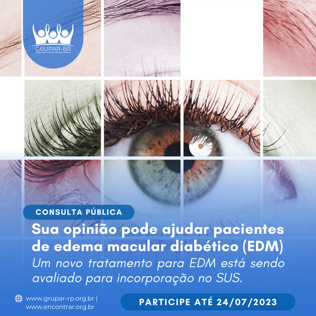 Sua opinião pode ajudar pacientes de edema macular diabético