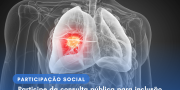 Participe da consulta pública para inclusão no SUS do medicamento Durvalumabe
