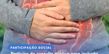 Participe da consulta pública para inclusão no SUS do Infliximabe