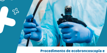 Participe da consulta pública sobre procedimento de ecobroncoscopia e ecoendoscopia em uso combinado, ou ecobroncoscopia em uso isolado, para pacientes com câncer de pulmão