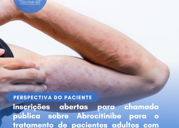 Dermatite Atópica: Abrocitinibe/Perspectiva do Paciente – Conitec