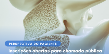 Osteoporose: Romosozumabe e teriparatida/Perspectiva do Paciente – Conitec