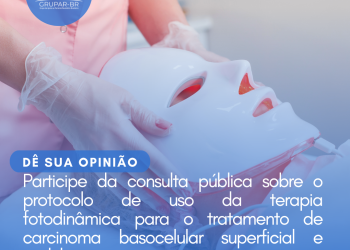 Carcinoma Basocelular Superficial e Nodular: Terapia Fotodinâmica/Consulta Pública – CONITEC