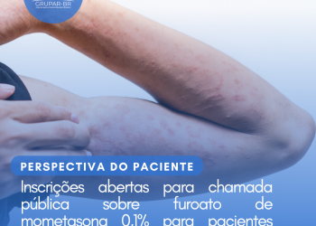Dermatite atópica: Furoato de mometasona 0,1%/Perspectiva do Paciente – CONITEC