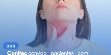 Conitec convida pacientes com câncer de cabeça e pescoço para contribuir com a perspectiva do paciente