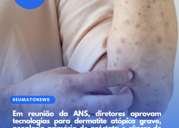 Em reunião da ANS, diretores aprovam tecnologias para dermatite atópica grave, neoplasia primária de próstata e câncer de pulmão de células não pequenas