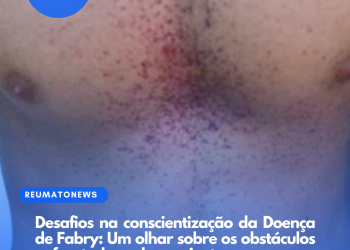 Desafios na conscientização da Doença de Fabry: Um olhar sobre os obstáculos enfrentados pelos pacientes