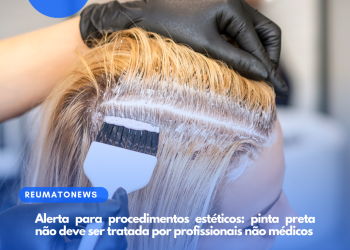 Alerta para procedimentos estéticos: pinta preta não deve ser tratada por profissionais não médicos