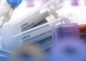 Lúpus: a importância da pesquisa clínica na busca de novos tratamentos para a doença