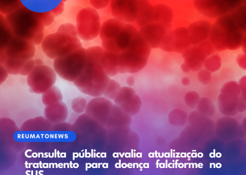 Consulta pública avalia atualização do tratamento para doença falciforme no SUS