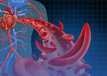 SUS vai disponibilizar dois novos medicamentos para a doença falciforme