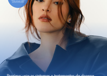 Psoríase: veja os sintomas e tratamentos da doença autoimune incurável que acomete a apresentadora Ana Clara