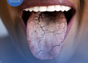 Doença de Sjögren é síndrome rara que também pode afetar os pulmões