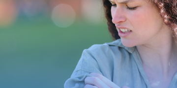 Urticária: Conheça a jornada do paciente