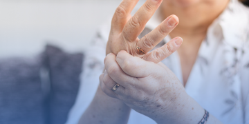 Artrite Reumatoide: saiba o que é e como prevenir a doença