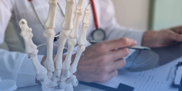 Novos tratamentos e perspectivas de medicina de precisão para pacientes de artrite reumatoide