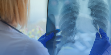 Análises da 33ª reunião técnica da Cosaúde