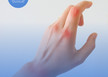 Médico explica tratamento para doença sem cura de Zé Felipe: ‘Efeitos colaterais’