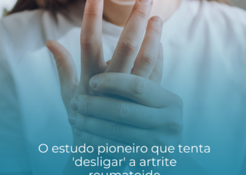 O estudo pioneiro que tenta ‘desligar’ a artrite reumatoide.