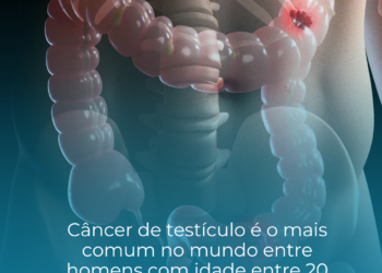 Câncer de testículo é o mais comum no mundo entre homens com idade entre 20 a 29 anos