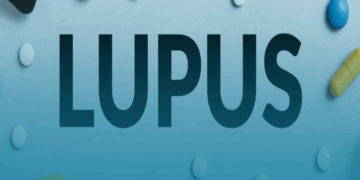 Possível novo medicamento para tratamento do lúpus: entenda como funciona
