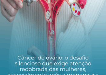 Câncer de ovário: o desafio silencioso que exige atenção redobrada das mulheres, especialmente após a menopausa.