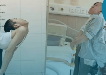 Após cirurgias na coluna, jovem chinês consegue ficar em pé e deitar pela 1ª vez