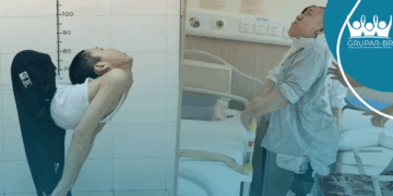 Após cirurgias na coluna, jovem chinês consegue ficar em pé e deitar pela 1ª vez