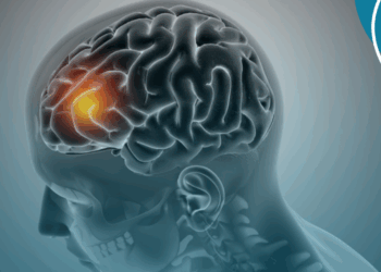 AVC é a segunda principal causa de morte no Brasil