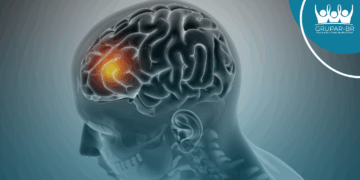 AVC é a segunda principal causa de morte no Brasil