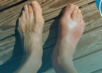 Dores reumáticas podem gerar incapacidade profissional