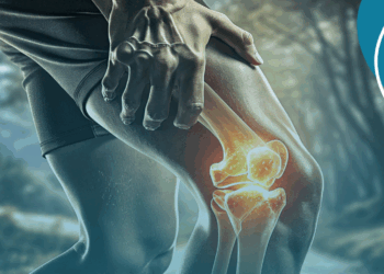 Dor nas articulações? Ortopedista revela 6 mitos sobre a artrose