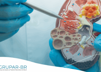 Atenção pacientes com doença renal crônica (DRC): A Conitec abre consulta pública nº 81 para incorporar o finerenona no tratamento