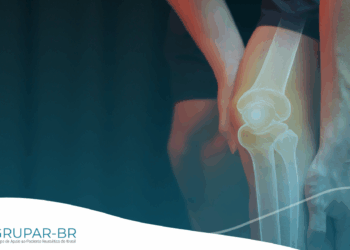 Hidrogel para problemas no joelho pode substituir a cirurgia