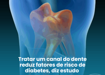 Tratar um canal do dente reduz fatores de risco de diabetes, diz estudo