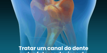 Tratar um canal do dente reduz fatores de risco de diabetes, diz estudo
