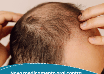 Novo medicamento oral contra queda de cabelo promete maior eficácia e menos riscos à saúde