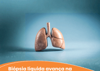 Biópsia líquida avança na detecção de mutações no câncer de pulmão