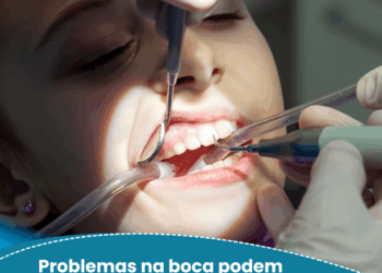 Problemas na boca podem indicar doenças autoimunes