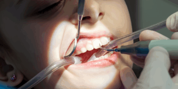 Problemas na boca podem indicar doenças autoimunes