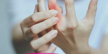 Pesquisa identifica mais de 900 genes ligados à artrose: 500 inéditos