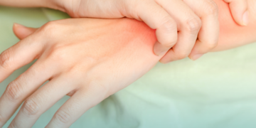 Ministério da Saúde atualiza PCDTs de artrites com ajustes regulatórios no acesso a medicamentos