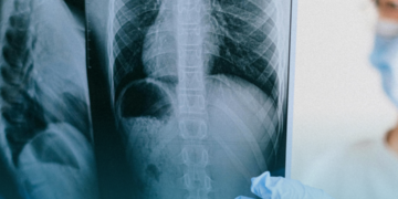 Cosaúde analisa contribuições e debate propostas de incorporação de novas tecnologias para o tratamento do câncer colorretal metastático, câncer de próstata e câncer de pulmão