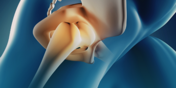 Dor e inchaço nas juntas costumam indicar artrite em fase inicial